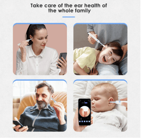 LAST DAY-50%OFFClean Earwax-Wi-Fi Visible Wax Removal Spoon, USB 1296P HD Load Otoscope