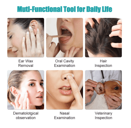 LAST DAY-50%OFFClean Earwax-Wi-Fi Visible Wax Removal Spoon, USB 1296P HD Load Otoscope